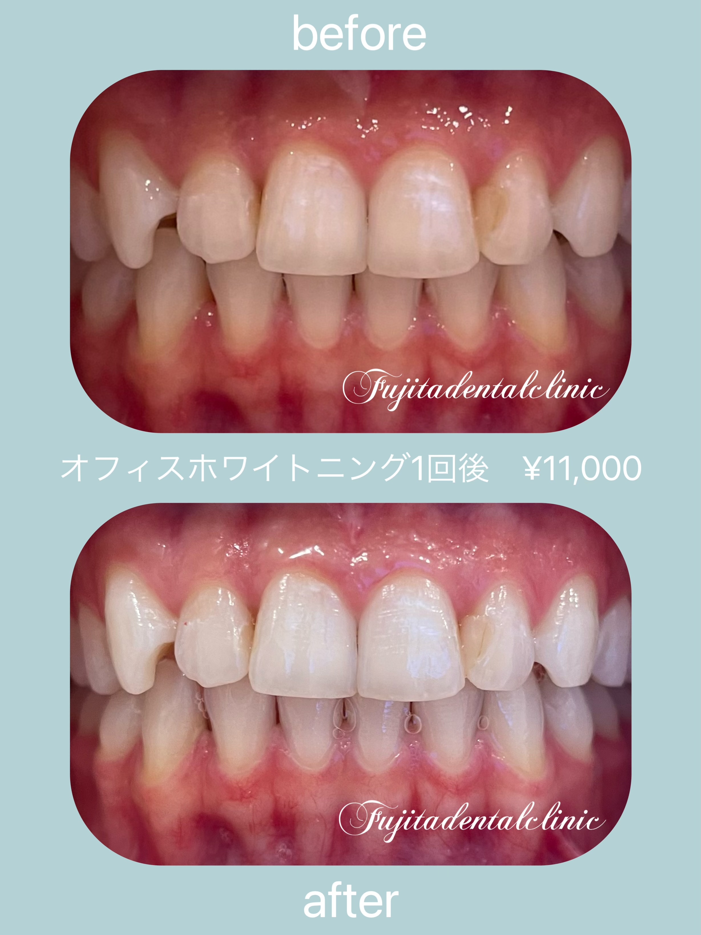 は