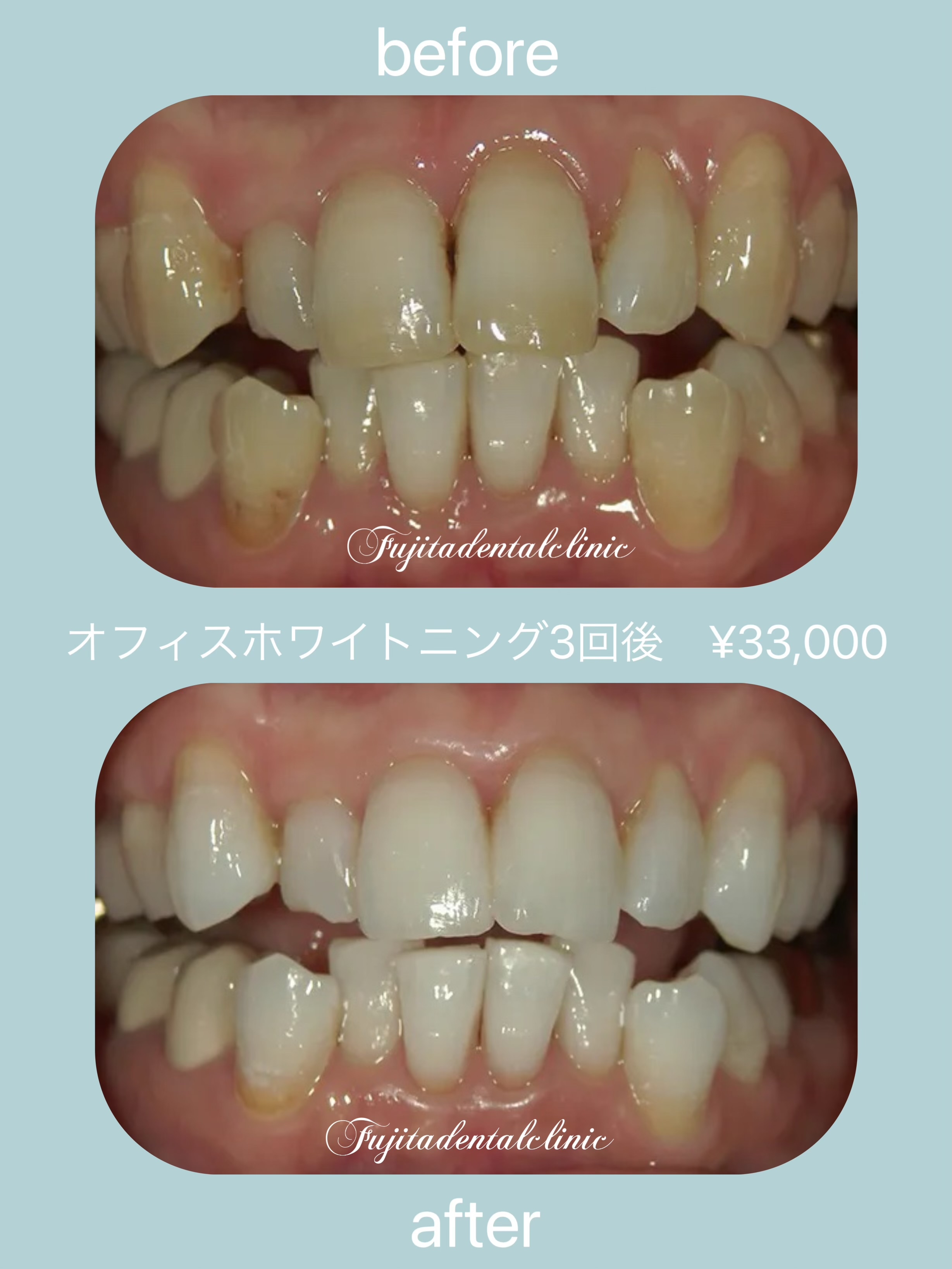 は